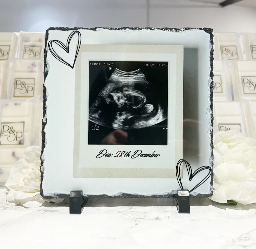 Scan Heart Design - Image 2